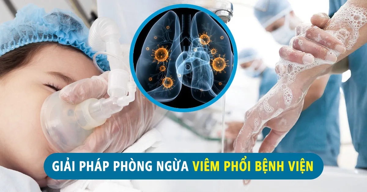 Biểu đồ thống kê các yếu tố nguy cơ gây viêm phổi bệnh viện, một vấn đề quan trọng trong y tế cộng đồng.