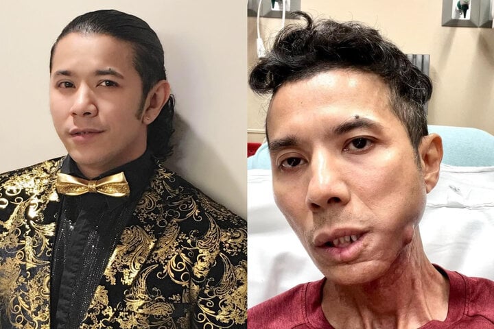 Kasim Hoàng Vũ biểu diễn đầy đam mê trên sân khấu