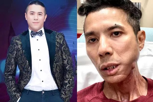 Kasim Hoàng Vũ với nụ cười rạng rỡ, đầy sức sống