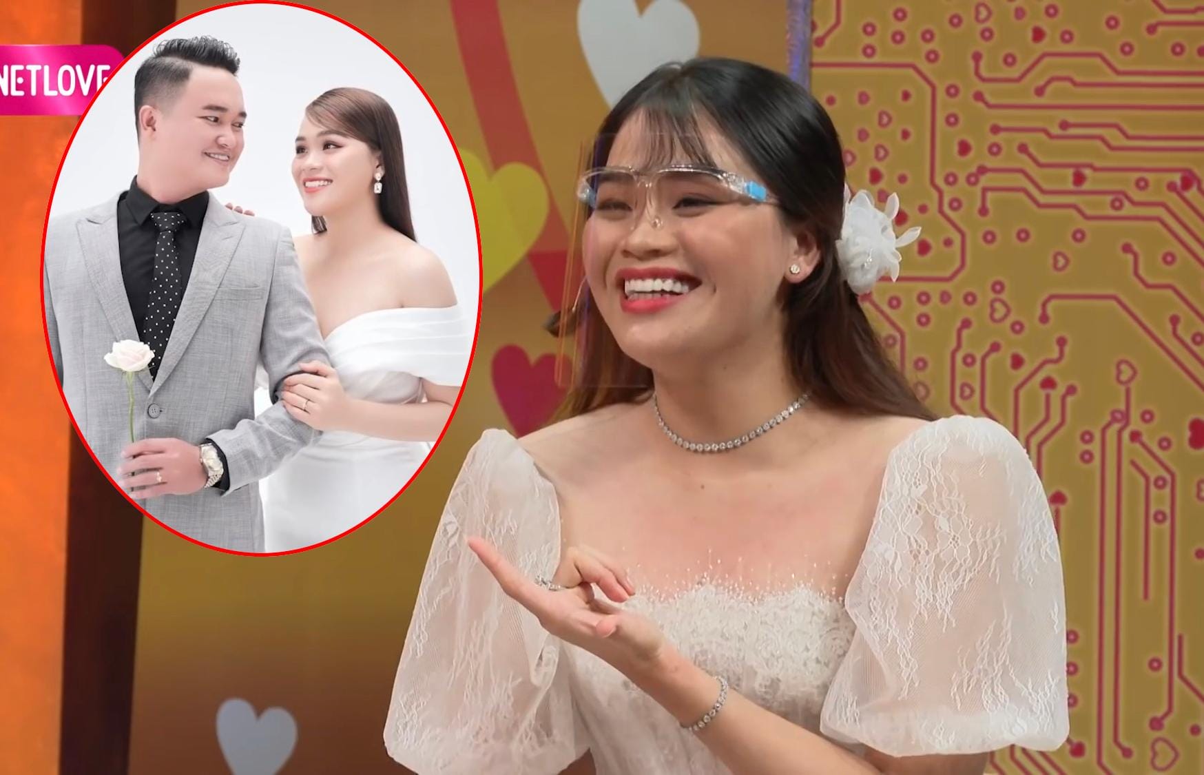 Chân dung Ngân Thảo, "Thánh Sún" trước khi thay đổi diện mạo hàm răng.
